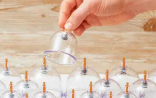 hijama treatment